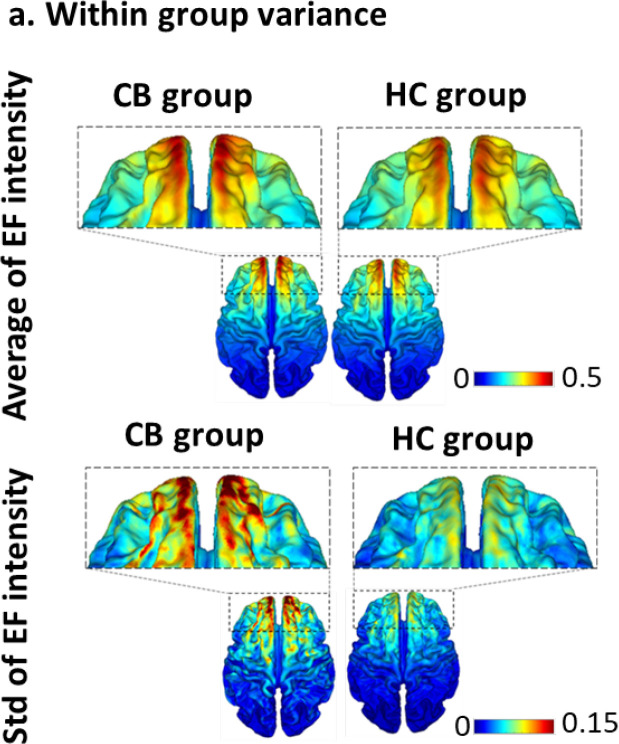 Cortical Morphology in Cannabis Use Disorder: Implications for Transcranial Direct Current Stimulation Treatment.