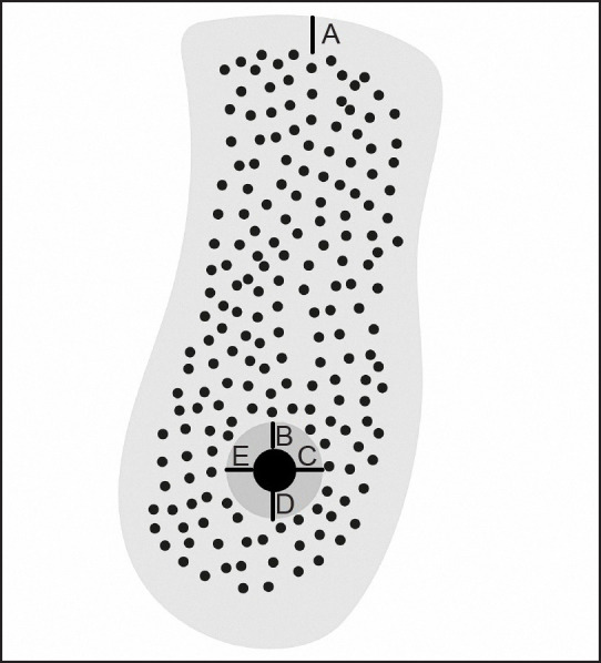 Evaluation of Cortical Thicknesses and Bone Density Values of Mandibular Canal Borders and Coronal Site of Alveolar Crest.