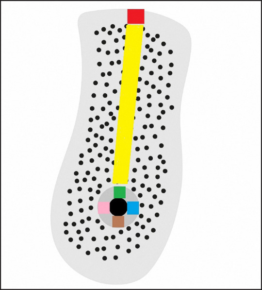 Evaluation of Cortical Thicknesses and Bone Density Values of Mandibular Canal Borders and Coronal Site of Alveolar Crest.