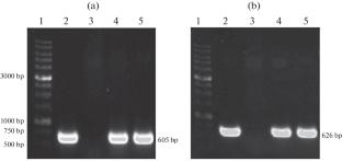 Overcoming the Protective Barriers of Cells in the Transformation of Bacteria with Exogenous DNA Using the Example of Rhodobacter capsulatus