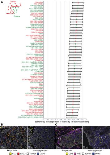 Integration of peripheral blood- and tissue-based biomarkers of response to immune checkpoint blockade in urothelial carcinoma