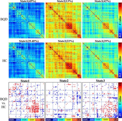 Dynamic functional connectivity changes associated with decreased memory performance in betel quid dependence