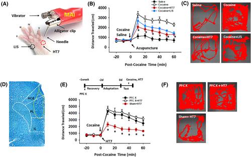 Mediation of mPFC-LHb pathway in acupuncture inhibition of cocaine psychomotor activity