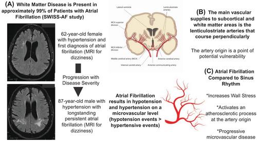 Commentary: All models are wrong, but some are useful: understanding cognitive decline and dementia in atrial fibrillation through vascular computational modelling