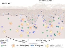 Skin Infiltrate Composition as a Telling Measure of Responses to Checkpoint Inhibitors