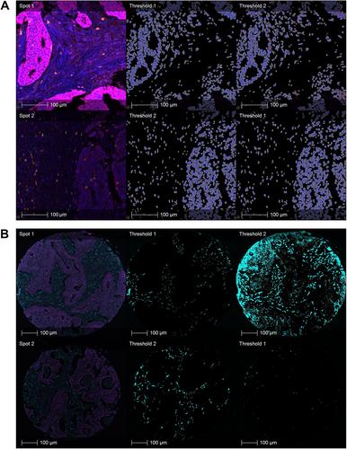 Accounting for intensity variation in image analysis of large-scale multiplexed clinical trial datasets