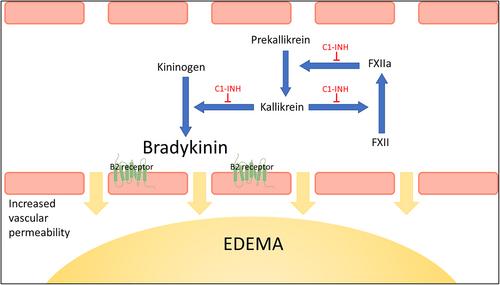 Could it be hereditary angioedema?—Perspectives from different medical specialties