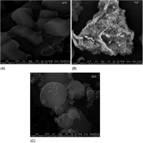 Nanoencapsulation of oral-pharmaceutical lactoferrin using chitosan and the evaluation of stability against trypsin and pepsin and its antibacterial effect