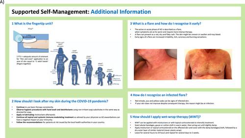 A concept for integrated care pathways for atopic dermatitis—A GA2LEN ADCARE initiative