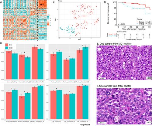 Digital image analysis allows objective stratification of patients with silent PIT1-lineage pituitary neuroendocrine tumors