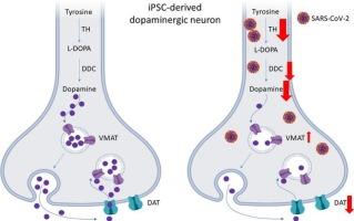 SARS-CoV-2 hampers dopamine production in iPSC-derived dopaminergic neurons