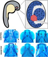 Intravitreal injection of FGF and TGF-β inhibitors disrupts cranial cartilage development