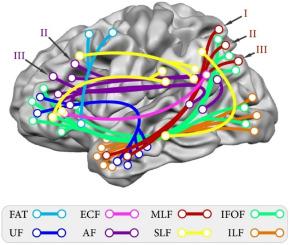 Anatomo-functional profile of white matter tracts in relevance to language: A systematic review