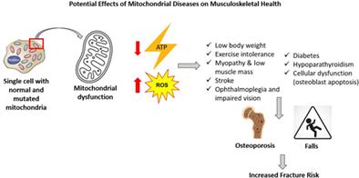 Skeletal Health in Patients With Mitochondrial Diabetes: Case Series and Review of Literature