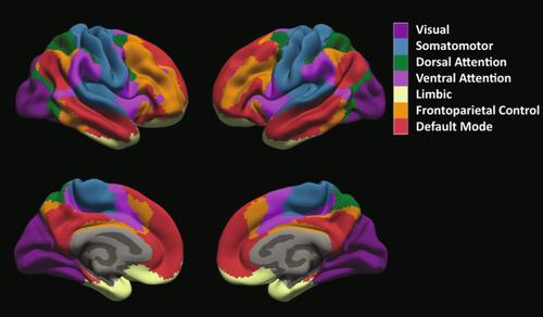 Limbic network co-localization predicts pharmacoresistance in dysplasia-related epilepsy