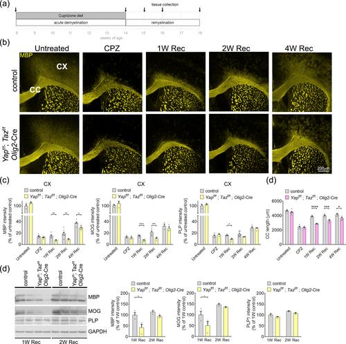 YAP and TAZ regulate remyelination in the central nervous system