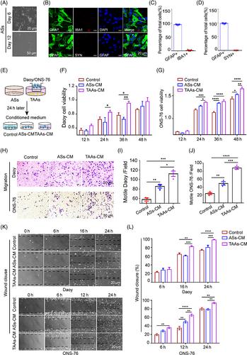 Tumor-associated astrocytes promote tumor progression of Sonic Hedgehog medulloblastoma by secreting lipocalin-2