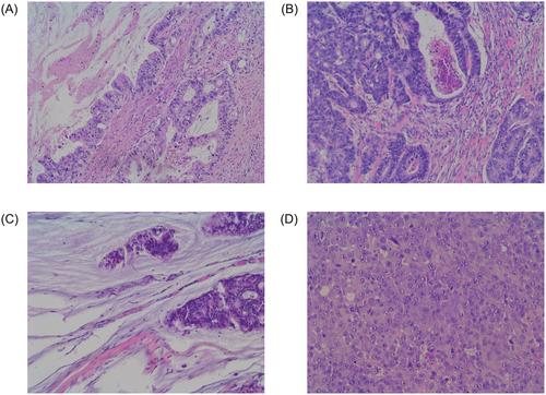 Atypical (non-V600E) BRAF mutations in metastatic colorectal cancer in population and real-world cohorts