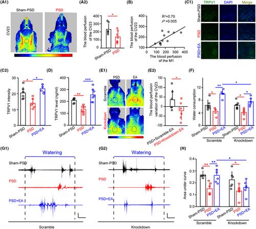 Role of TRPV1 in electroacupuncture-mediated signal to the primary sensory cortex during regulation of the swallowing function