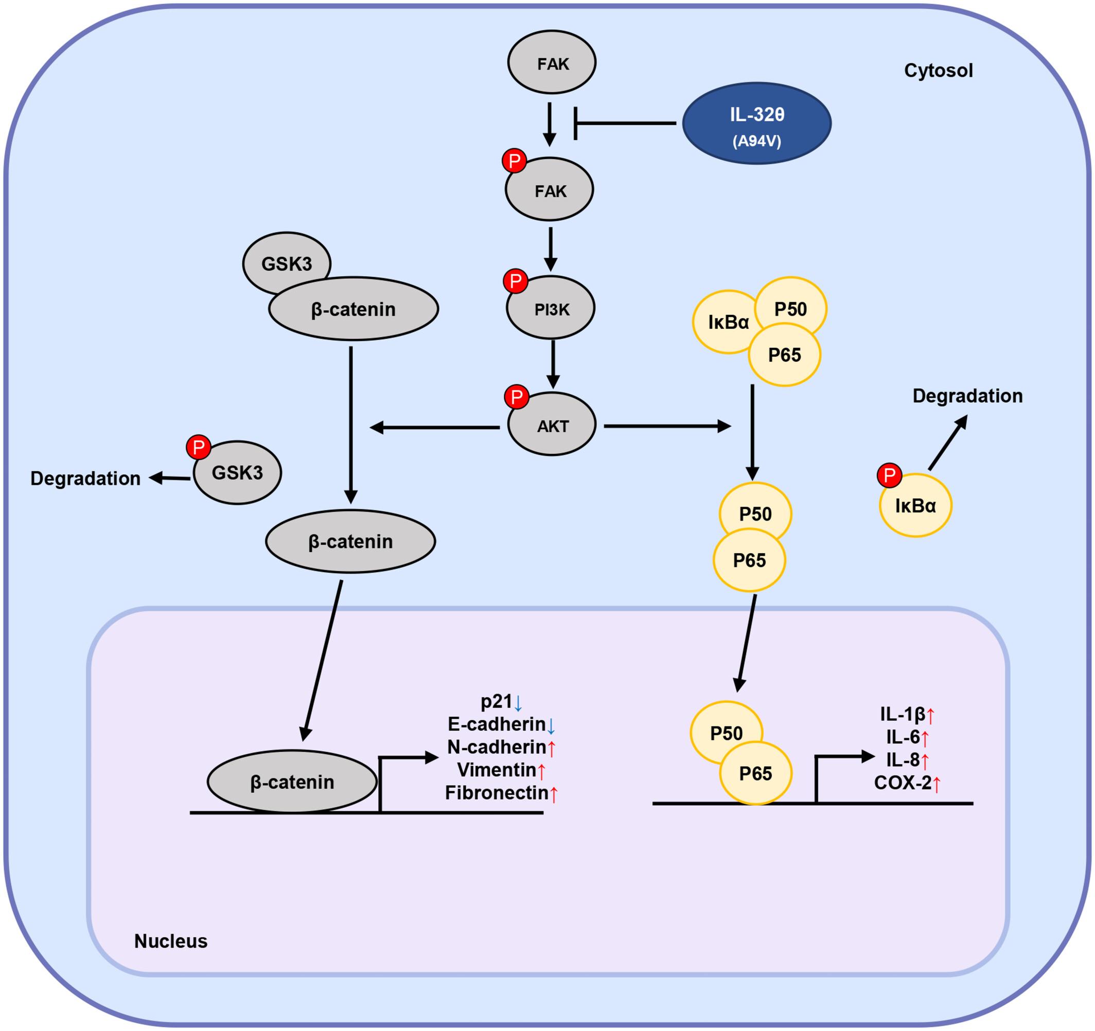 Modulatory effects of point-mutated IL-32θ (A94V) on tumor progression in triple-negative breast cancer cells