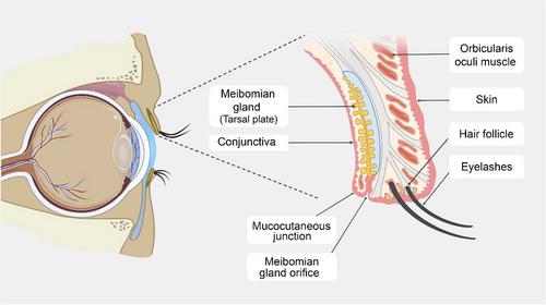 Intense pulsed light treatment in meibomian gland dysfunction: Past, present, and future