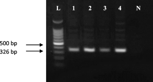 Advancing Nematode Identification on Potato: An Isothermal Recombinase Polymerase Amplification Assay for Stubby Root Nematode, Paratrichodorus allius