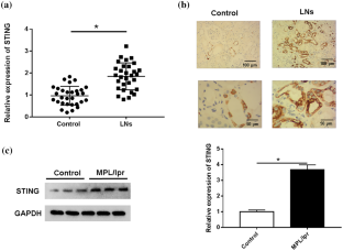 STING upregulation mediates ferroptosis and inflammatory response in lupus nephritis by upregulating TBK1 and activating NF-κB signal pathway