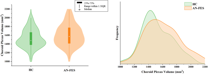 Choroid plexus volume enlargement in first-episode antipsychotic-naïve schizophrenia