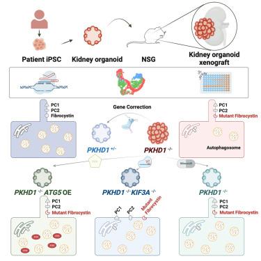 Kidney organoid models reveal cilium-autophagy metabolic axis as a therapeutic target for PKD both in vitro and in vivo