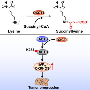 OXCT1 functions as a succinyltransferase, contributing to hepatocellular carcinoma via succinylating LACTB