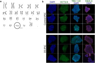 Trisomy 21 Alters Cell Proliferation and Migration of iPSC-Derived Cardiomyocytes on Type VI Collagen