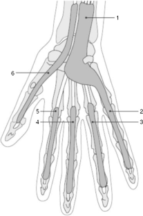 An Update on Suppurative Tenosynovitis