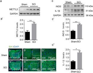 METTL3 promotes microglial inflammation via MEF2C in spinal cord injury.