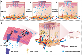 Fabrication of lidocaine-loaded polymer dissolving microneedles for rapid and prolonged local anesthesia