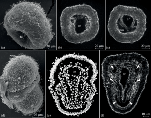 Two Sources of Mesoderm in Brachiopods.