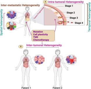 From complexity to clarity: unravelling tumor heterogeneity through the lens of tumor microenvironment for innovative cancer therapy.