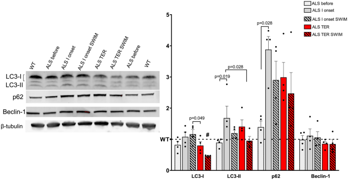 Spinal cord abnormal autophagy and mitochondria energy metabolism are modified by swim training in SOD1-G93A mice.