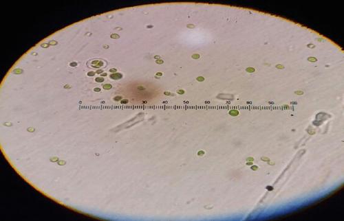 Utilization of microalgae for agricultural runoff remediation and sustainable biofuel production through an integrated biorefinery approach