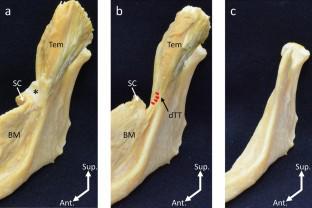 Three-dimensional Analysis of the Muscles Related to the So-Called "Pterygomandibular Raphe": An Anatomical and Histological Study.