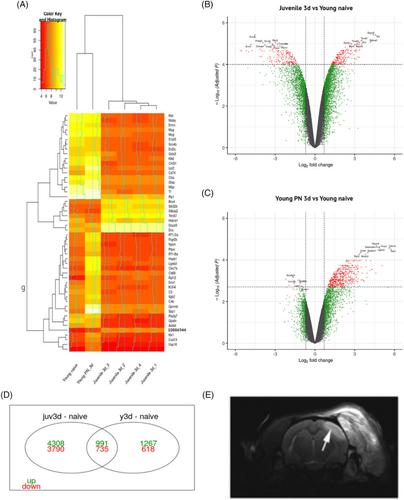 The post-stroke young adult brain has limited capacity to re-express the gene expression patterns seen during early postnatal brain development