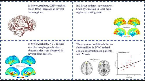 Altered neurovascular coupling in migraine without aura