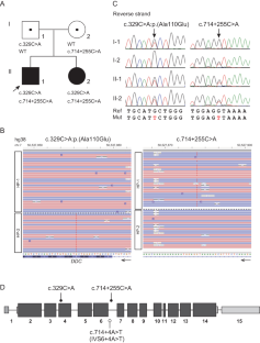 Detection of hidden intronic DDC variant in aromatic L-amino acid decarboxylase deficiency by adaptive sampling