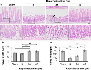 The crucial role of SETDB1 in structural and functional transformation of epithelial cells during regeneration after intestinal ischemia reperfusion injury.