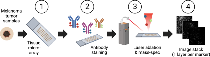 Mapping the single cell spatial immune landscapes of the melanoma microenvironment