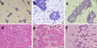 Comparative Transcriptome Analysis Reveals the Role of Ribosome Reduction in Impeding Oogenesis in Female Triploid Crassostrea Gigas