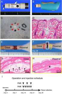 A new lymphedema treatment using pyro-drive jet injection