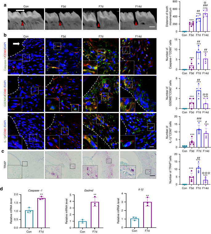 Force-induced Caspase-1-dependent pyroptosis regulates orthodontic tooth movement.