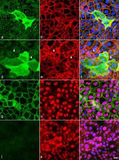 JNK inhibition enhances cell-cell adhesion impaired by desmoglein 3 gene disruption in keratinocytes.