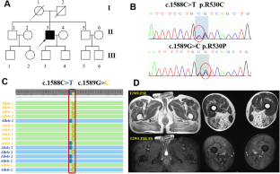 A comparative study on riboflavin responsive multiple acyl-CoA dehydrogenation deficiency due to variants in FLAD1 and ETFDH gene