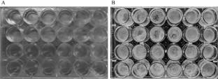 Observation of a Bone Invasion Model of Aspergillus fumigatus In Vitro and Analysis of the Antifungal Susceptibility.